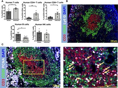 Humanized Mice Exhibit Exacerbated Abscess Formation and Osteolysis During the Establishment of Implant-Associated Staphylococcus aureus Osteomyelitis